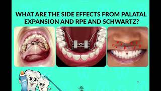 What are the Side Effects of Expansion in Schwartz and RPE [upl. by Brittan878]