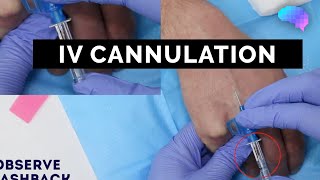 Intravenous IV cannulation  OSCE Guide  UKMLA  CPSA [upl. by Lua]