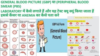 CBC SE GBP या PBS GENERAL BLOOD PICTURE or PERIPHERAL BLOOD SMEAR KI REPORT KAISE BANAYE [upl. by Elysia639]