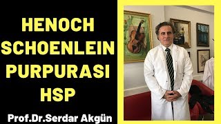 Henoch Schonlein Purpurası HSP Serdar Akgün [upl. by Bonneau]