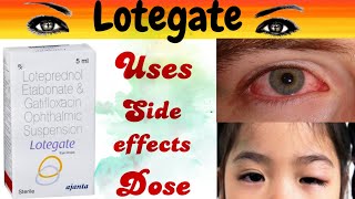 lotegate eye drops  lotegate eye drop uses  gatifloxacin loteprednol ophthalmic suspension [upl. by Juieta224]