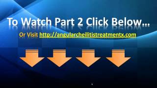 Angular Cheilitis Treatment  Angular Cheilitis Home Remedies [upl. by Aynas]