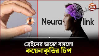 এবার চোখে দেখবে জন্মান্ধও  Neuralink  Elon Musk  Channel 24 [upl. by Marijo]