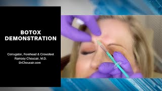 Botox® Demonstration Corrugators Forehead amp Crowsfeet  Ramsey Choucair MD  Ph 2143899797 [upl. by Westfall924]