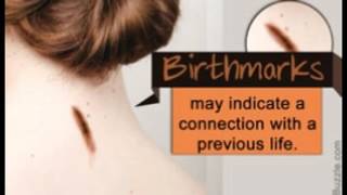 Are Birthmarks Related to Our Past Life Experiences [upl. by Ainocal]