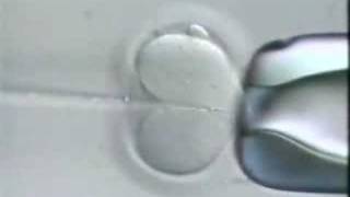 Intra Cytoplasmic Sperm Injection ICSI [upl. by Martica566]