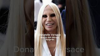 Donatella Versace Now VS Without Surgeries 90s donatellaversace versace shortsfeed runway [upl. by Caddric718]