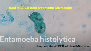 Entamoeba in Stool Microscopy [upl. by Muhcan763]