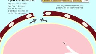 Understanding Pneumothorax in Dogs and Cats [upl. by Hendry]