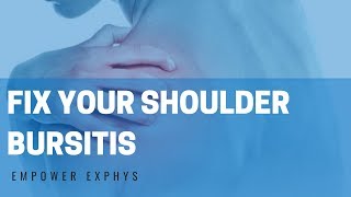 The best exercises for shoulder bursitis [upl. by Murrah]