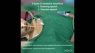 Cerebellar dysarthria  Scanning speech and Staccato speech  DrKamaleshTNMediCalLectures [upl. by Melquist37]