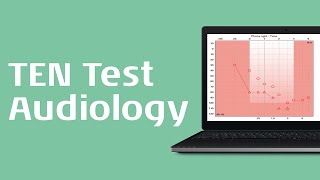 TEN Test Procedure [upl. by Arno]