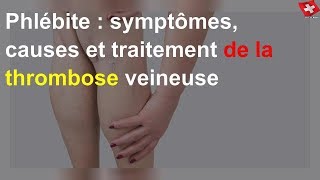 Phlébite  symptômes causes et traitement de la thrombose veineuse [upl. by Ecirad]