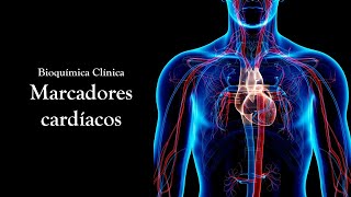 Marcadores Cardíacos  Bioquímica Clínica amp Infarto do Miocárdio [upl. by Yzzo]