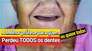 Descubra a MELHOR PRÓTESE DENTÁRIA para quem PERDEU TODOS OS DENTES [upl. by Inoj]