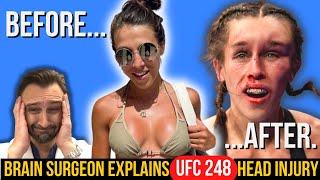 BRAIN SURGEON Explains Shocking UFC 248 Head Injury  Joanna Jedrzejczyk vs Zhang Weili [upl. by Shute]