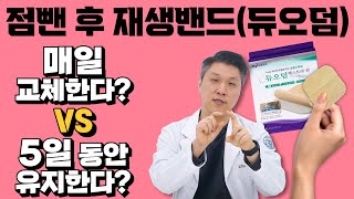 점뺀 후 듀오덤은 매일 교체하는 게 맞을까 계속 붙이고 있는 게 맞을까 [upl. by Anomer]