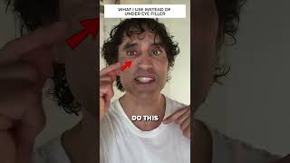 DISSOLVING MY UNDER EYE FILLER REACTION [upl. by Elnar]