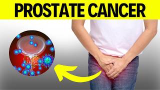 Prostate Cancer Signs  Warning Signs of Prostate Cancer [upl. by Namso332]