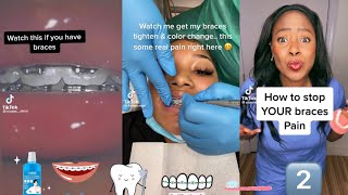 Braces Tips pt2 TikTok Compilation [upl. by Weiman]