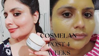 Cosmelan Peel indian skin journey pigmentation skincare aesthetic antiaging [upl. by Harms]