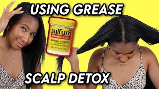 HOW I USE SULFUR 8 GREASE TO GET RID OF DANDRUFF [upl. by Rhines]