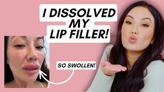 I Dissolved My Lip Filler Heres Why  Beauty with Susan Yara [upl. by Krein]