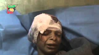 Syria  Douma  Innocent Child Takes His Last Breaths  Nov 20 2012 [upl. by Ahsaten]