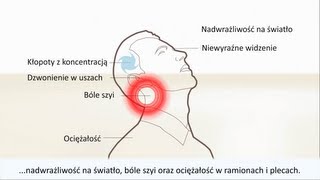 Uszkodzenie kręgów szyjnych  Uraz kręgosłupa szyjnego  Objawy i leczenie [upl. by Nedla587]