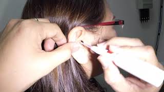 Removing Lady Doctors Earwax using Lighted Ear Curette [upl. by Nolava]