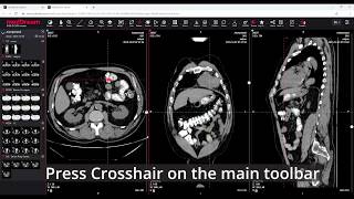 MedDream DICOM Viewer MPR feature [upl. by Denys]