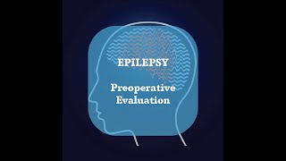 Neurosurgery Basics Lecture  Epilepsy  Preoperative evaluation [upl. by Schroer]