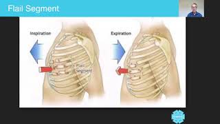 Flail Segment  Australian Paramedical College [upl. by Wunder]