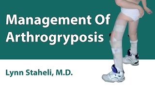 Management Of Arthrogryposis [upl. by Arrat179]