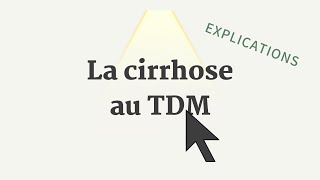 Cirrhose au TDM  Conf Apollon [upl. by Ahsiadal]