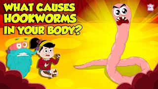 What causes Hookworm। Intestinal Worms Symptoms and Treatment  Worm Infection  Dr Binocs Show [upl. by Einnaej558]