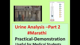 Urine Analysis l Complete Urine Test l Part 2 l Marathi l Urine Abnormal Constituents l BT CT [upl. by Assiluy]