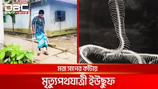 মরা সাপের কাঁটায় মৃত্যুপথযাত্রী ইউছুফ  DBC NEWS Special [upl. by Idas]