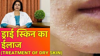 सूखी त्वचा  ड्राई स्किन का ईलाज  Dry Skin Treatment In HINDI [upl. by Aianat335]