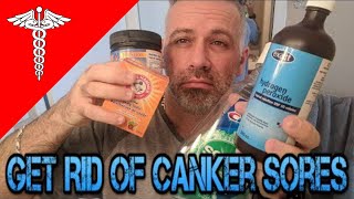 How To Get Rid of Canker Sore PAIN [upl. by Nay689]