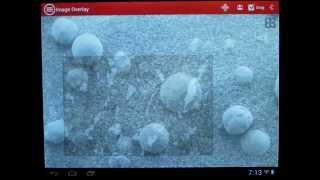 mVision  A Microscopic App for Android [upl. by Leacim584]