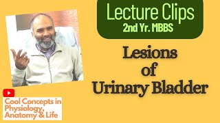 Lesions of the Urinary Bladder  Neurogenic bladder  Incontinence  2nd Year MBBS [upl. by Nitsugua]