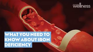 What you need to know about iron deficiency and supplementation [upl. by Medina886]