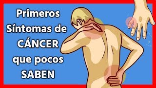 Síntomas y Signos de Cáncer  Conócelos a tiempo [upl. by Hound]